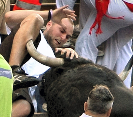 Thats going to need some stitches. 